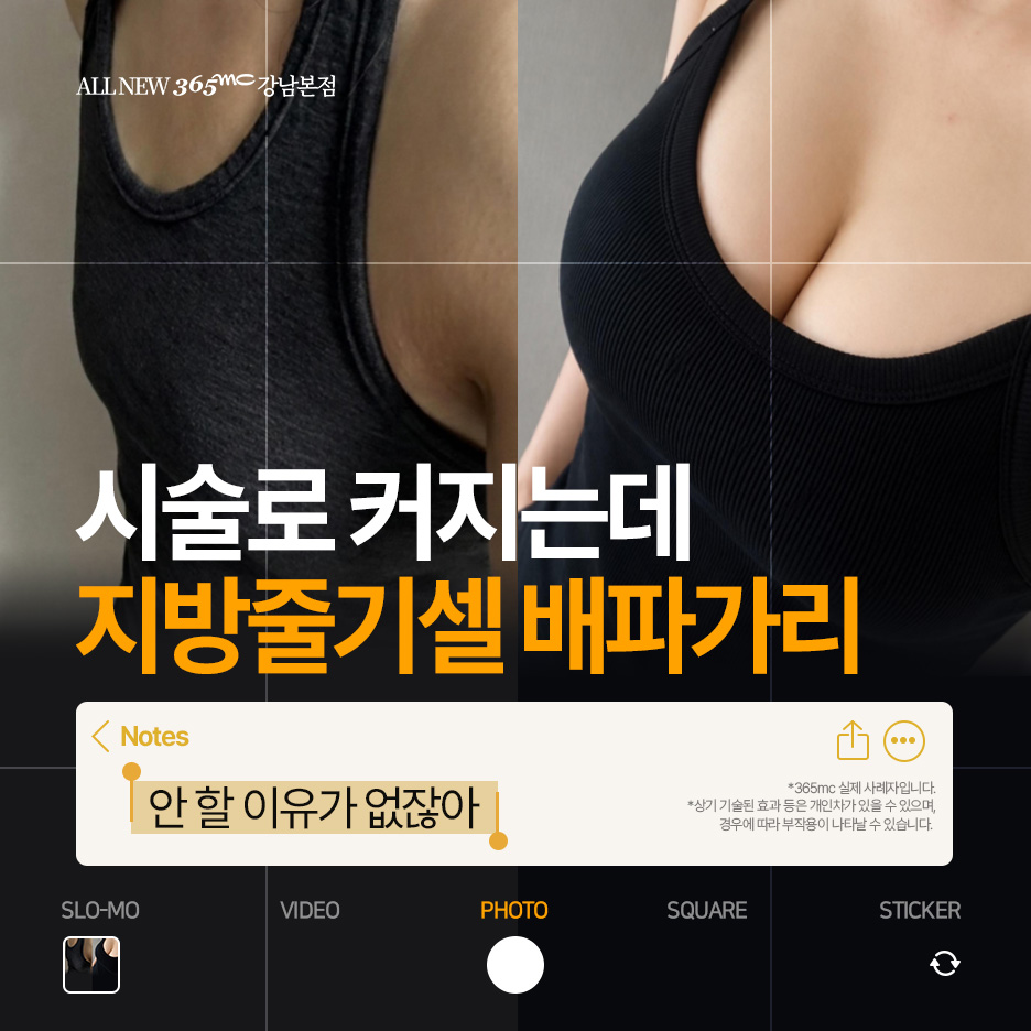 지방줄기세포 회복·관리 Q&A 관련 안내 이미지